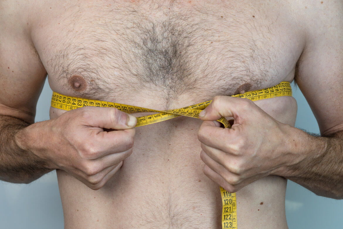 Male Breast Reduction: Exploring Gynecomastia Surgery